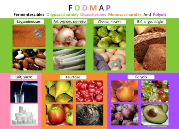 intestin irritable fodmap